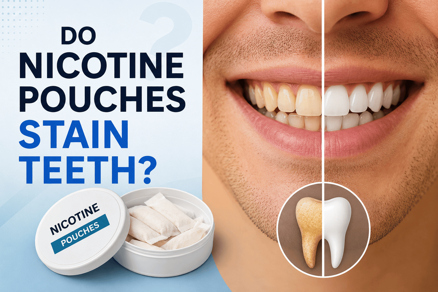 Do Nicotine Pouches Stain Teeth